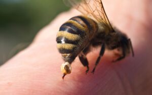 picada de abelha o que fazer